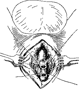 Urethra: figure 17 from the 1928–1936 encyclopedia article