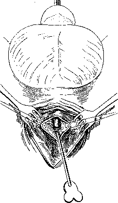 Urethra: figure 11 from the 1928–1936 encyclopedia article