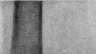 Pubic Symphysis: figure 1 from the 1928–1936 encyclopedia article