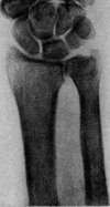 Pubic Symphysis: figure 5 from the 1928–1936 encyclopedia article