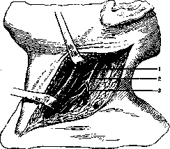 Denervation: figure 1 from the 1928–1936 encyclopedia article
