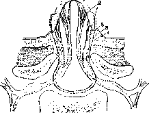 Spina Bifida: figure 4 from the 1928–1936 encyclopedia article