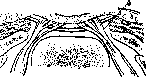 Spina Bifida: figure 1 from the 1928–1936 encyclopedia article