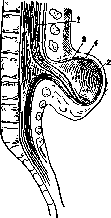 Spina Bifida: figure 11 from the 1928–1936 encyclopedia article