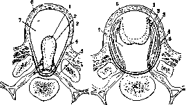 Spina Bifida: figure 9 from the 1928–1936 encyclopedia article