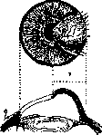 Staphyloma: figure 2 from the 1928–1936 encyclopedia article