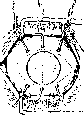 Staphyloma: figure 5 from the 1928–1936 encyclopedia article