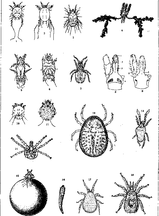 Cellulitis (a1332): figure 1 from the 1928–1936 encyclopedia article