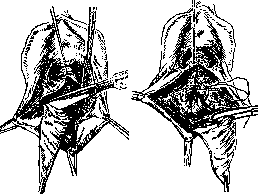Colpopoiesis: figure 6 from the 1928–1936 encyclopedia article