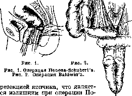 Colpopoiesis: figure 1 from the 1928–1936 encyclopedia article