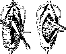 Colpopoiesis: figure 2 from the 1928–1936 encyclopedia article