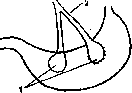 Gastropexy: figure 3 from the 1928–1936 encyclopedia article