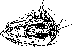 Rectum: figure 24 from the 1928–1936 encyclopedia article