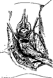 Rectum: figure 18 from the 1928–1936 encyclopedia article