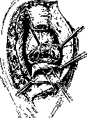 Rectum: figure 17 from the 1928–1936 encyclopedia article