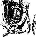 Rectum: figure 28 from the 1928–1936 encyclopedia article
