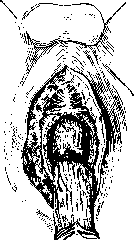 Rectum: figure 22 from the 1928–1936 encyclopedia article