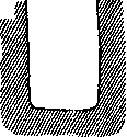 Amputation: figure 4 from the 1928–1936 encyclopedia article