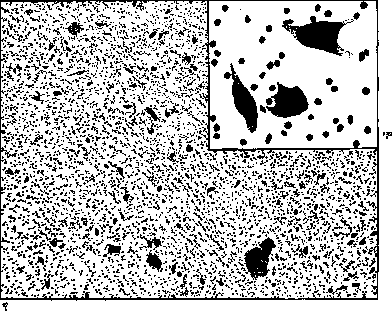 Basal Ganglia: figure 4 from the 1928–1936 encyclopedia article