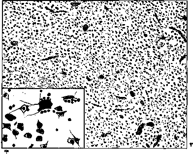 Basal Ganglia: figure 3 from the 1928–1936 encyclopedia article