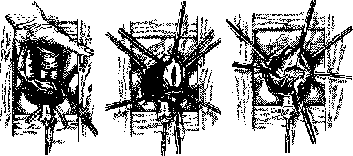 Urinary Bladder: figure 10 from the 1928–1936 encyclopedia article