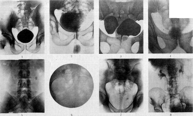 Urinary Bladder: figure 12 from the 1928–1936 encyclopedia article