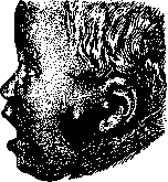 Abscess: figure 4 from the 1928–1936 encyclopedia article
