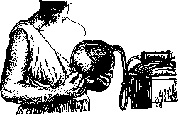 Abscess: figure 6 from the 1928–1936 encyclopedia article