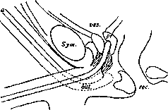 Catheterization: figure 1 from the 1928–1936 encyclopedia article