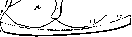 Retroperitoneal Space: figure 4 from the 1928–1936 encyclopedia article