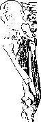 Fractures: figure 19 from the 1928–1936 encyclopedia article