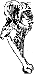 Fractures: figure 17 from the 1928–1936 encyclopedia article
