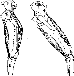 Fractures: figure 16 from the 1928–1936 encyclopedia article
