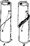 Fractures: figure 8 from the 1928–1936 encyclopedia article