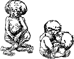 Malformations: figure 5 from the 1928–1936 encyclopedia article
