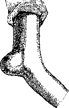 Bursitis: figure 2 from the 1928–1936 encyclopedia article