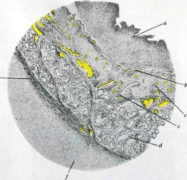 Inflammation: figure 5 from the 1928–1936 encyclopedia article