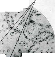 Inflammation: figure 4 from the 1928–1936 encyclopedia article