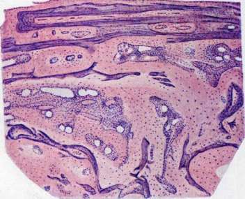 Inflammation: figure 7 from the 1928–1936 encyclopedia article
