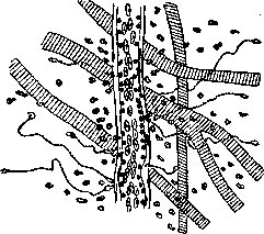 Inflammation: figure 1 from the 1928–1936 encyclopedia article