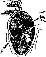 Gallbladder: figure 49 from the 1928–1936 encyclopedia article