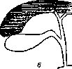 Gallbladder: figure 6 from the 1928–1936 encyclopedia article
