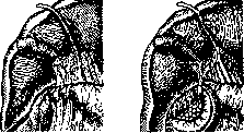 Gallbladder: figure 54 from the 1928–1936 encyclopedia article