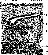 Gallbladder: figure 33 from the 1928–1936 encyclopedia article