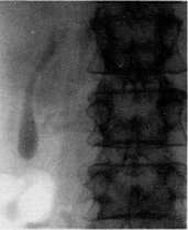 Gallbladder: figure 40 from the 1928–1936 encyclopedia article