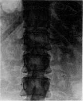 Gallbladder: figure 42 from the 1928–1936 encyclopedia article