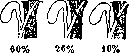 Gallbladder: figure 24 from the 1928–1936 encyclopedia article