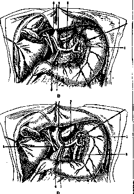 Gallbladder: figure 22 from the 1928–1936 encyclopedia article