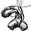 Gallbladder: figure 1 from the 1928–1936 encyclopedia article