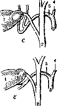 Gallbladder: figure 27 from the 1928–1936 encyclopedia article